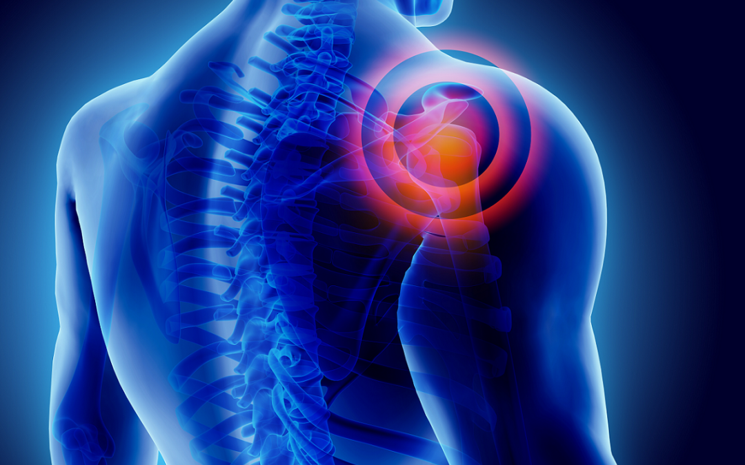 Rotator Cuff Injuries